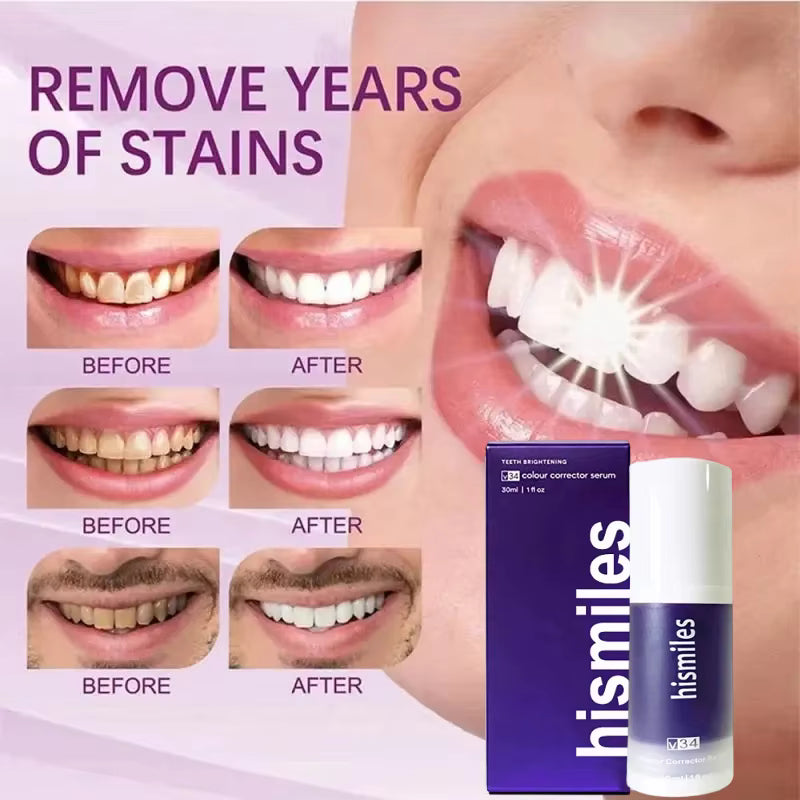 Purple Color Corrector – Natychmiastowo Bielszy Uśmiech w 2 Minuty